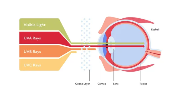 What Is UV Eye Damage